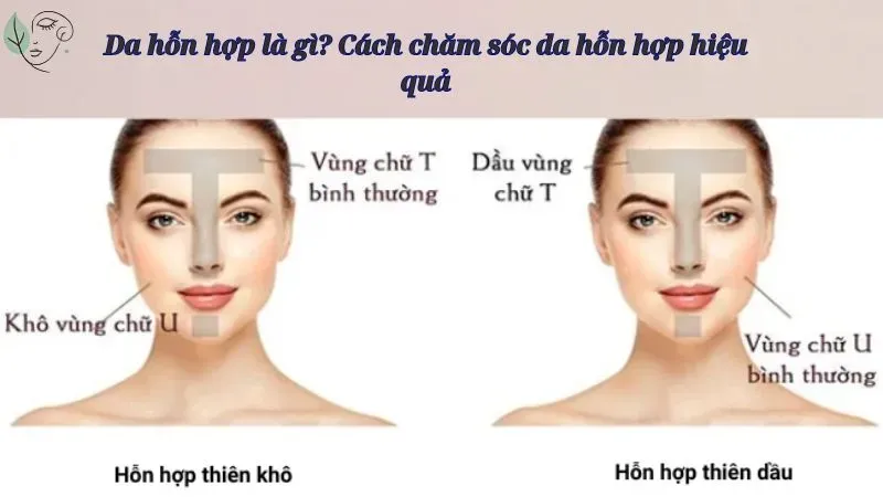 Da hỗn hợp là gì? Cách chăm sóc da hỗn hợp hiệu quả
