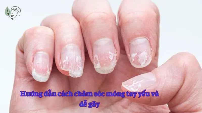 Hướng dẫn cách chăm sóc móng tay yếu và dễ gãy