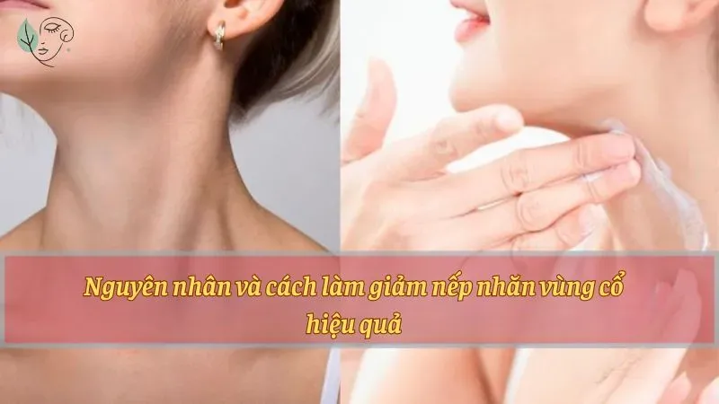 Nguyên nhân và cách làm giảm nếp nhăn vùng cổ hiệu quả