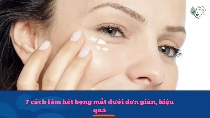 7 cách làm hết bọng mắt dưới đơn giản, hiệu quả
