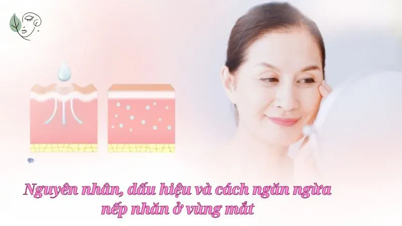 Nguyên nhân, dấu hiệu và cách ngăn ngừa nếp nhăn ở vùng mắt