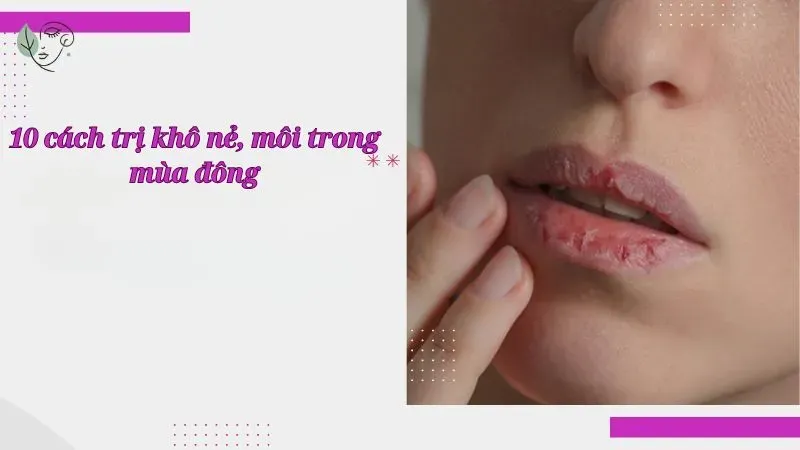 10 cách trị môi khô nẻ trong mùa đông