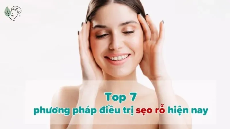 7 cách trị sẹo rỗ do mụn hiệu quả an toàn hiện nay