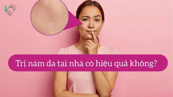 Cách điều trị nám da tại nhà có hiệu quả không?
