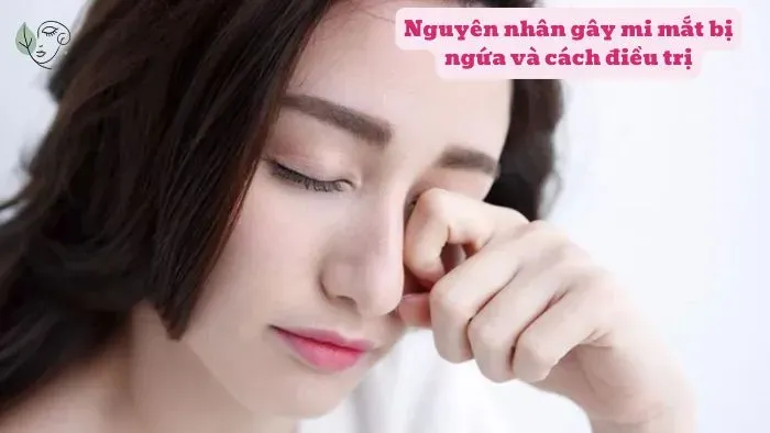 Nguyên nhân gây mi mắt bị ngứa và cách điều trị