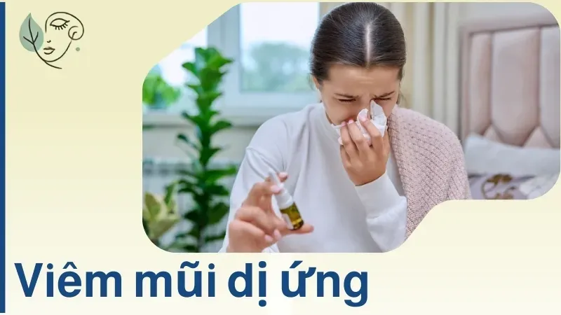 10 cách chữa viêm mũi dị ứng tại nhà hiệu quả nhất