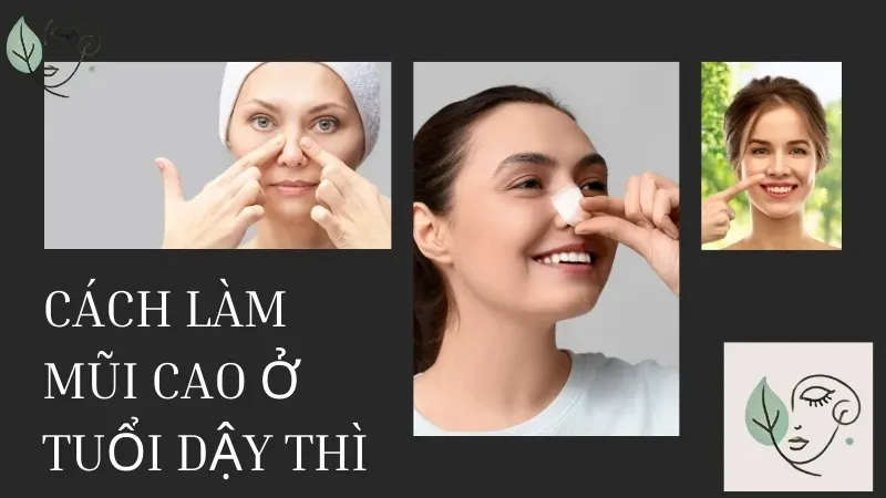 Có thật sự làm mũi cao ở tuổi dậy thì được không?