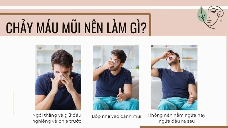 Chảy máu mũi nên làm gì? Cách xử lý hiệu quả ngay tại nhà