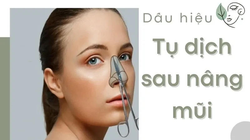 Các dấu hiệu bị tụ dịch sau nâng mũi - Hướng dẫn cách xử lý hiệu quả