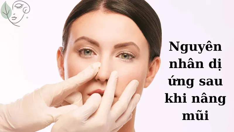Dấu hiệu dị ứng sau nâng mũi và cách khắc phục nhanh chóng