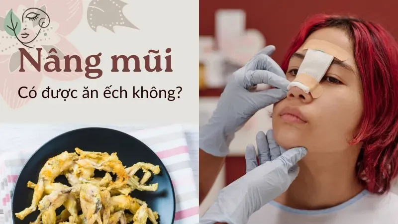 Nâng mũi xong ăn ếch được không? Những thực phẩm cần tránh xa