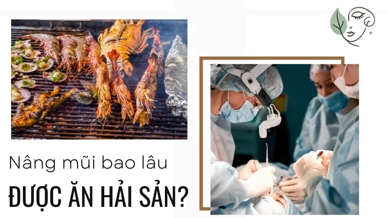 Nâng mũi kiêng hải sản bao lâu? Cách ăn uống đúng cách