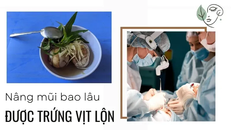 Ăn trứng vịt lộn sau nâng mũi khi nào để không ảnh hưởng vết thương?