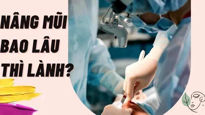 Nâng mũi bao lâu thì lành? Bí quyết giúp bạn hồi phục nhanh hơn