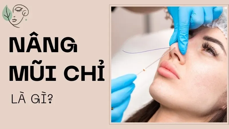 Nâng mũi chỉ là gì? Tác dụng phụ của nâng mũi chỉ