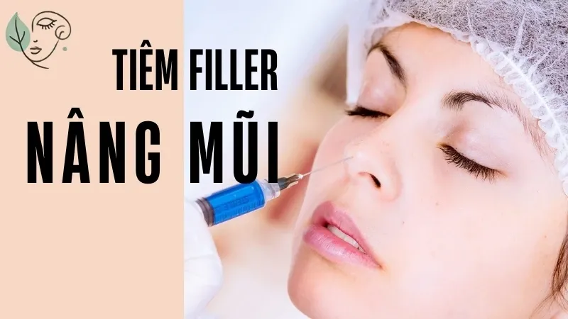 Tiêm nâng mũi có đau không? Ưu nhược điểm của tiêm nâng mũi