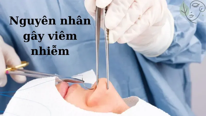 Viêm nhiễm sau phẫu thuật mũi - Nguy hiểm thế nào?