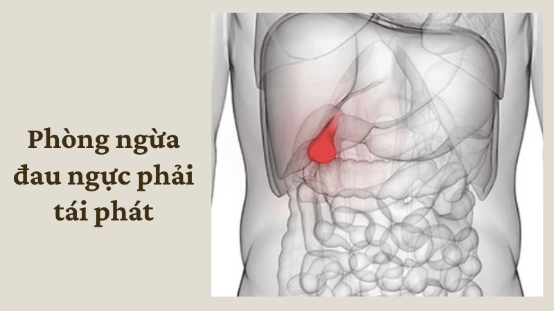 Phòng ngừa đau ngực phải tái phát