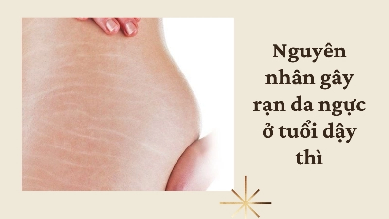 Nguyên nhân gây rạn da ngực ở tuổi dậy thì