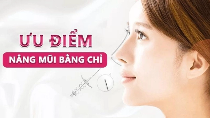 Ưu điểm nâng mũi chỉ nổi bật