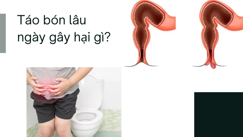 Táo bón kéo dài gây biến chứng nguy hiểm thế nào