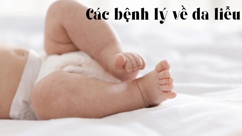 Các bệnh lý về da liễu phổ biến những tháng đầu