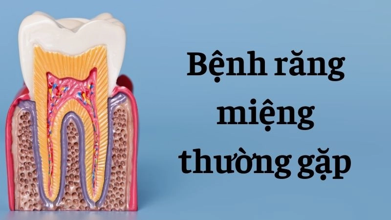Những thói quen xấu âm thầm tàn phá men răng