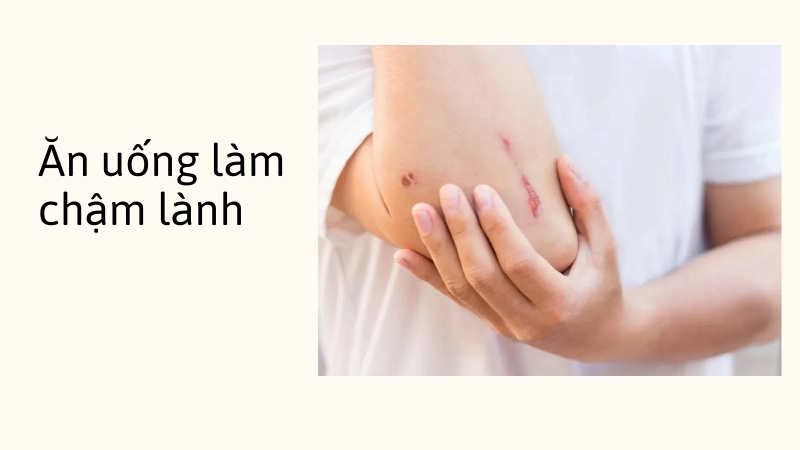 Sai lầm trong ăn uống khiến vết thương lâu lành