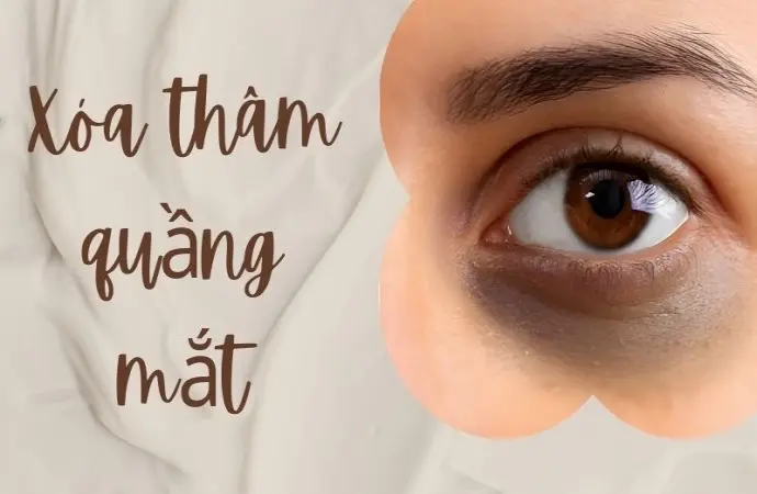 Xóa thâm quầng mắt đúng cách mang lại vẻ ngoài tươi trẻ