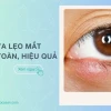 Bí quyết trị lẹo mắt nhanh nhất tại nhà
