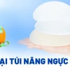 Các loại túi nâng ngực hiện nay: Đặc điểm và lưu ý