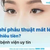 Chỉnh mắt lé kim bao nhiêu tiền và các yếu tố ảnh hưởng