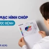 Giác mạc chóp là gì? Nguyên nhân, dấu hiệu và cách điều trị