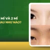 Mắt 2 mí và 1 mí: Phân biệt, đặc điểm và cách khắc phục hiệu quả