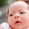 Mụn sữa ở trẻ sơ sinh: Nên tắm lá gì để làm dịu làn da nhạy cảm?