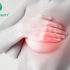 Nâng ngực bao lâu thì lành? Hướng dẫn chăm sóc sau phẫu thuật