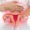 Polyp tử cung là gì? Tìm hiểu dấu hiệu và cách điều trị hiệu quả