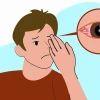Thuốc Nhỏ Mắt Trị Viêm Giác Mạc Hiệu Quả: Lựa Chọn Tối Ưu cho Đôi Mắt Sáng Khỏe