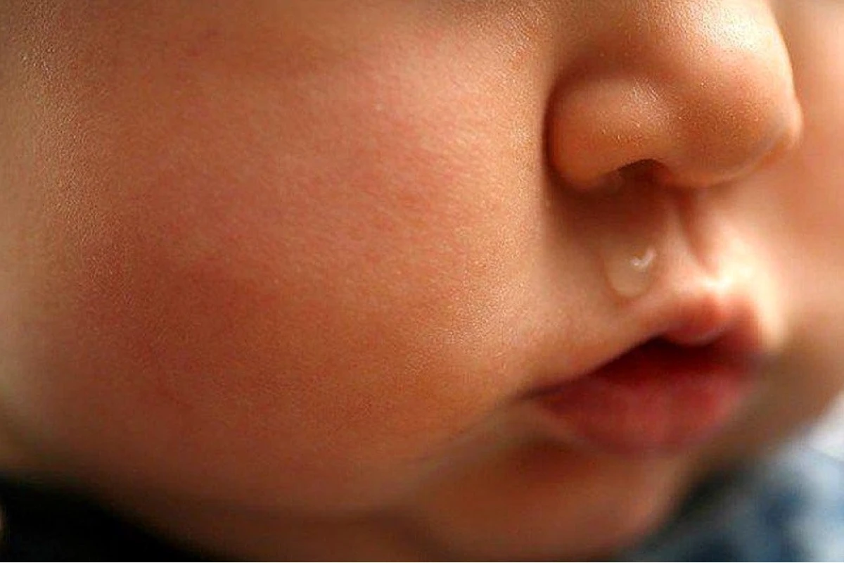 Bé Sổ Mũi Uống Thuốc Gì? Hướng Dẫn Chi Tiết Từ Chuyên Gia
