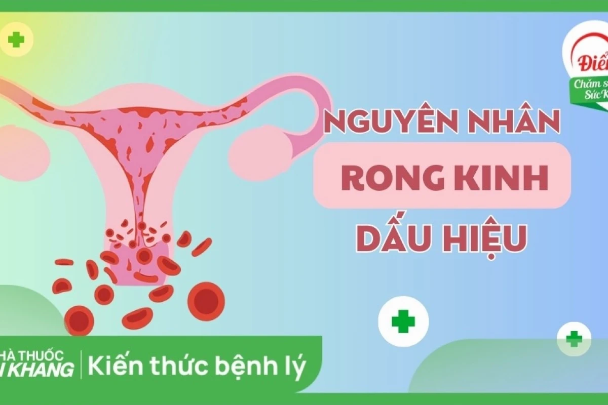 Rong Kinh Là Gì? Nguyên Nhân, Dấu Hiệu Và Cách Điều Trị Hiệu Quả Năm 2026