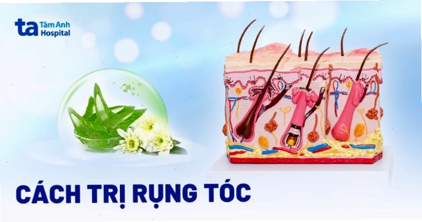 25 cách trị rụng tóc tự nhiên hiệu quả tại nhà