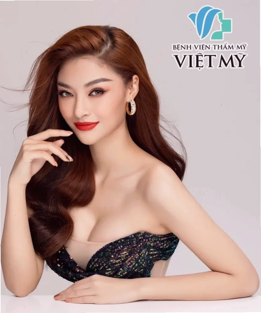 Á hậu Kiều Loan sau khi nâng ngực