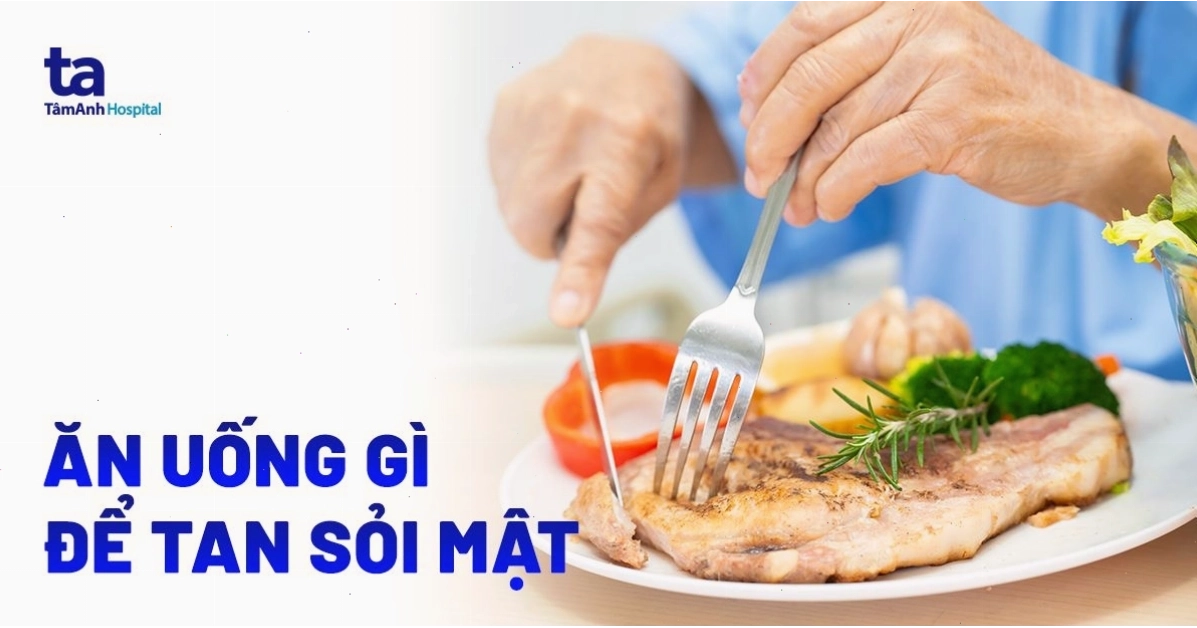 Ăn uống gì để tan sỏi mật? Nên kiêng ăn gì giảm triệu chứng bệnh?