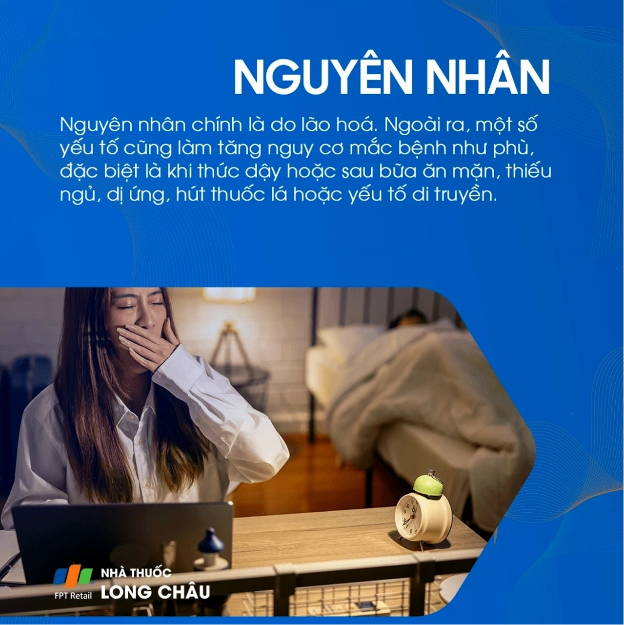 Ảnh hưởng của thiếu ngủ và căng thẳng đến việc hình thành bọng mắt
