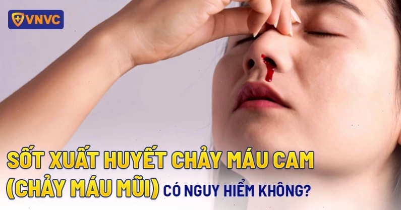 Biểu hiện chảy máu mũi khi mắc sốt xuất huyết
