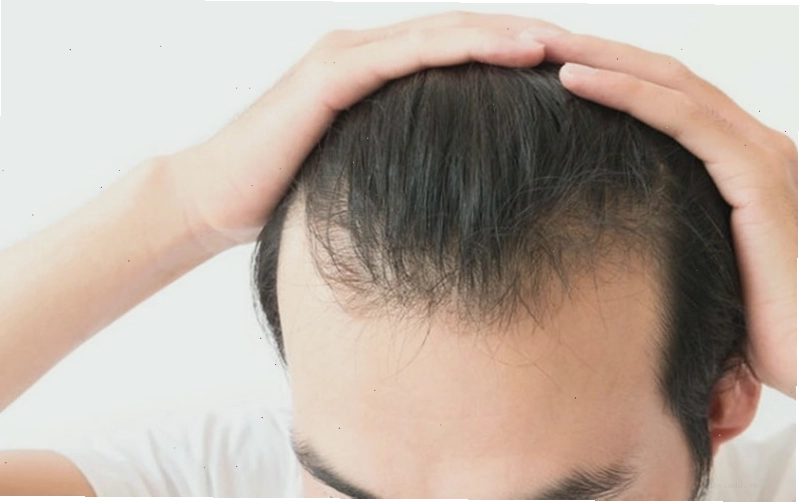 Các bước chăm sóc tóc giúp cải thiện tình trạng tóc bò liếm