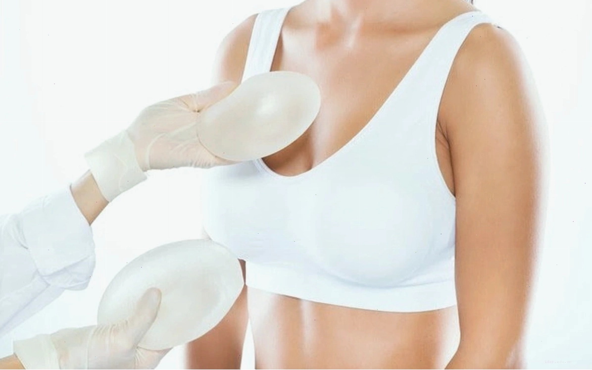 Các loại túi độn nâng ngực phổ biến trên thị trường