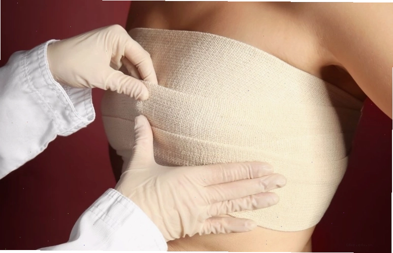 Các loại túi độn ngực khác nhau có thể yêu cầu thời gian mặc áo định hình khác nhau