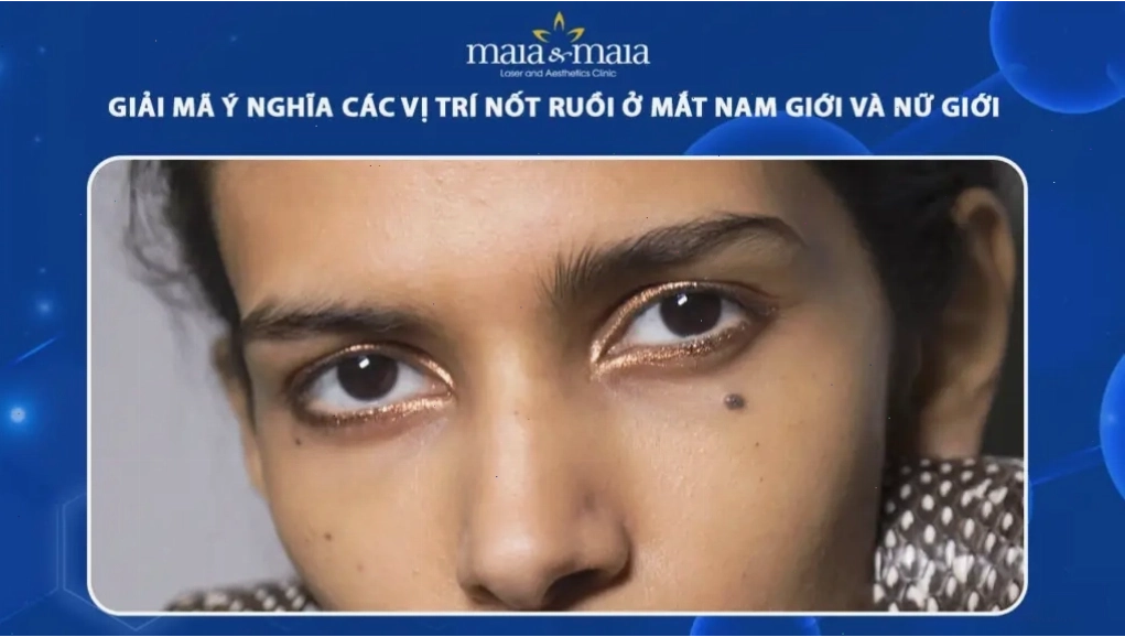 Các nốt ruồi quanh mắt, bao gồm cả nốt ruồi ở mắt và nốt ruồi đón lệ, đều mang những ý nghĩa phong thủy riêng