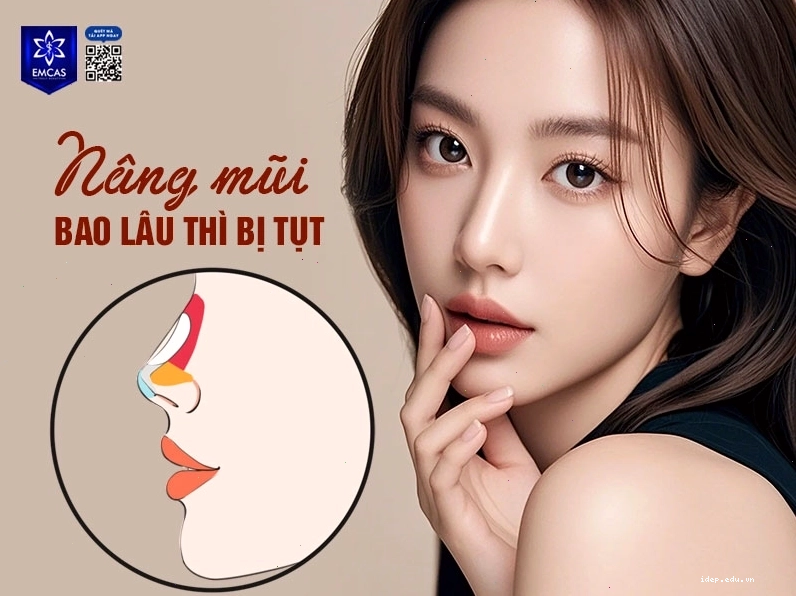 Cách phòng tránh tụt sụn mũi sau nâng